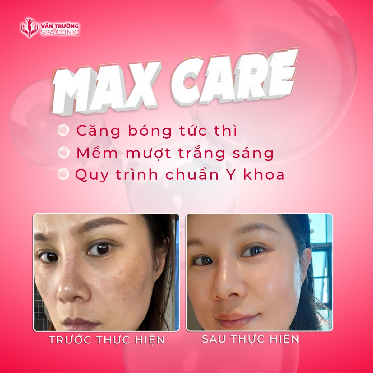 max care 4