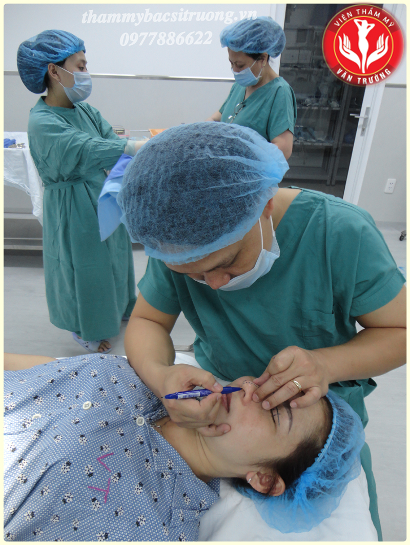 Nâng mũi Hàn Quốc