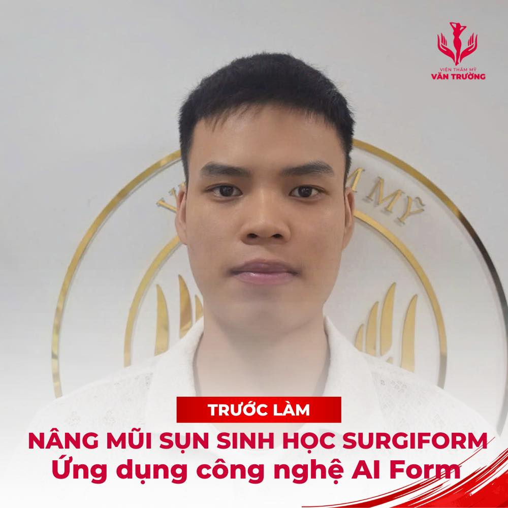 trước phẫu thuật
