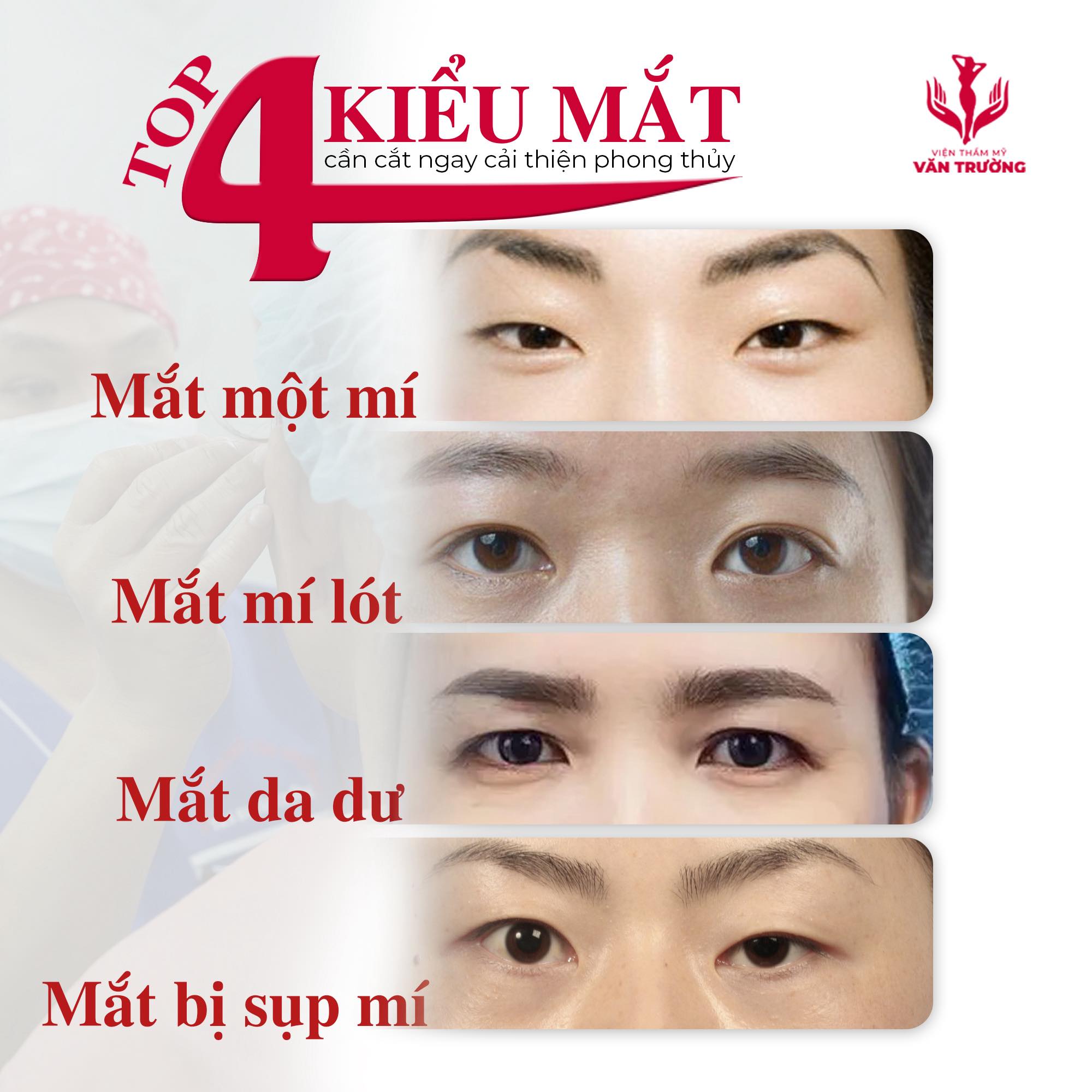 Cắt mí Laser mini line 5D