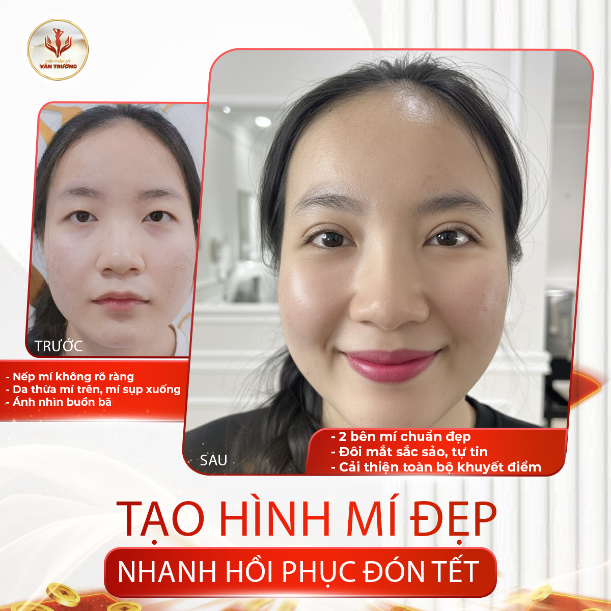 mí đẹp