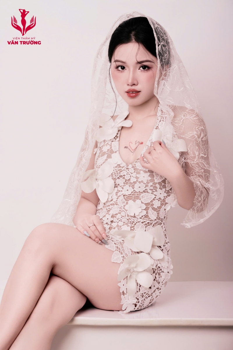 mũi đẹp văn trường 4