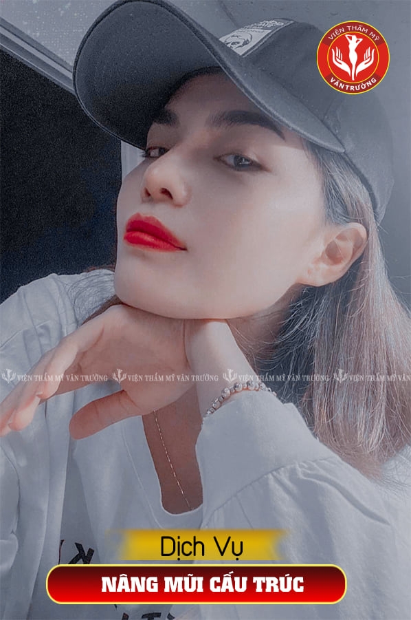 Nâng mũi S-line đẹp ở Đà Nẵng 6