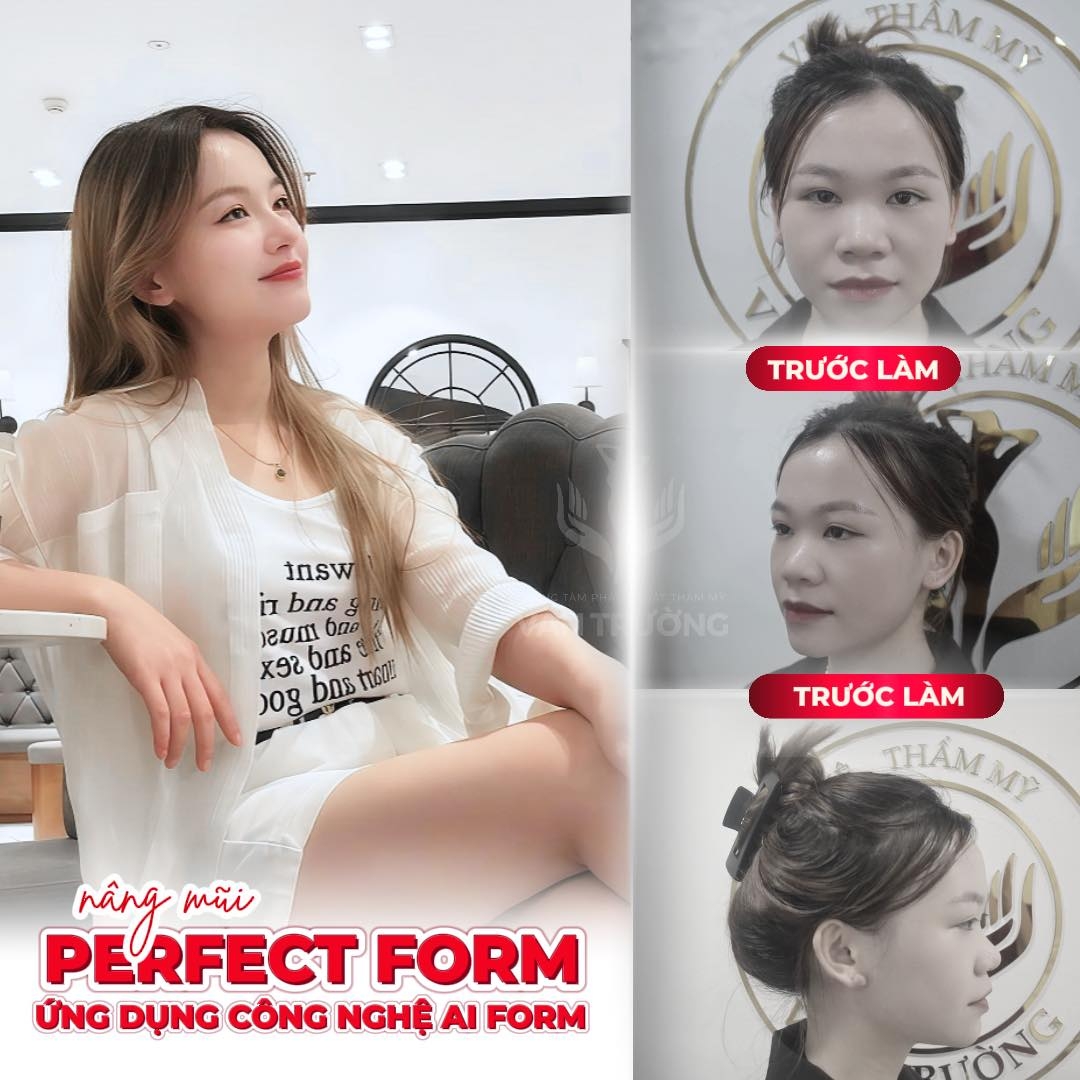 NÂNG MŨI PERFECT FORM