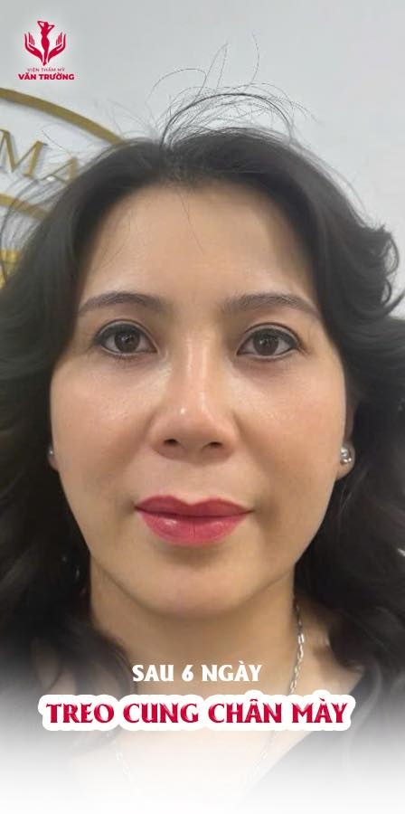 TREO CUNG CHÂN MÀY