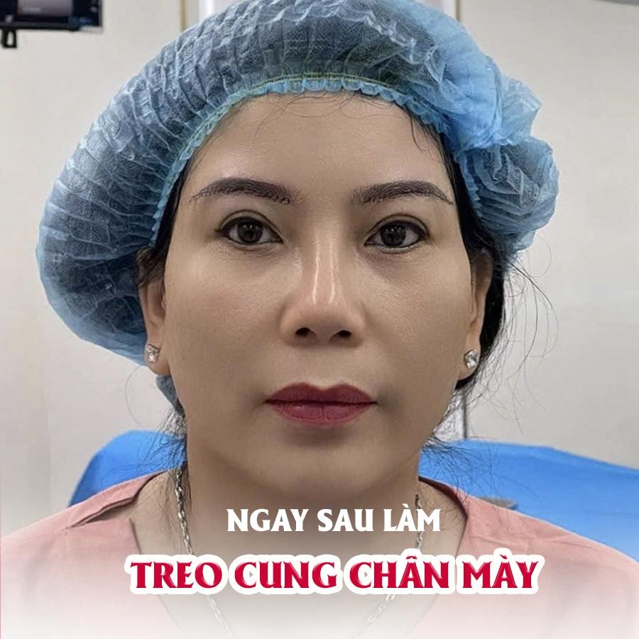 TREO CUNG CHÂN MÀY