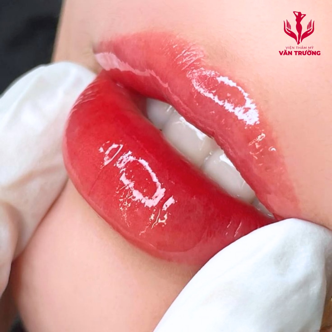 môi đẹp 2