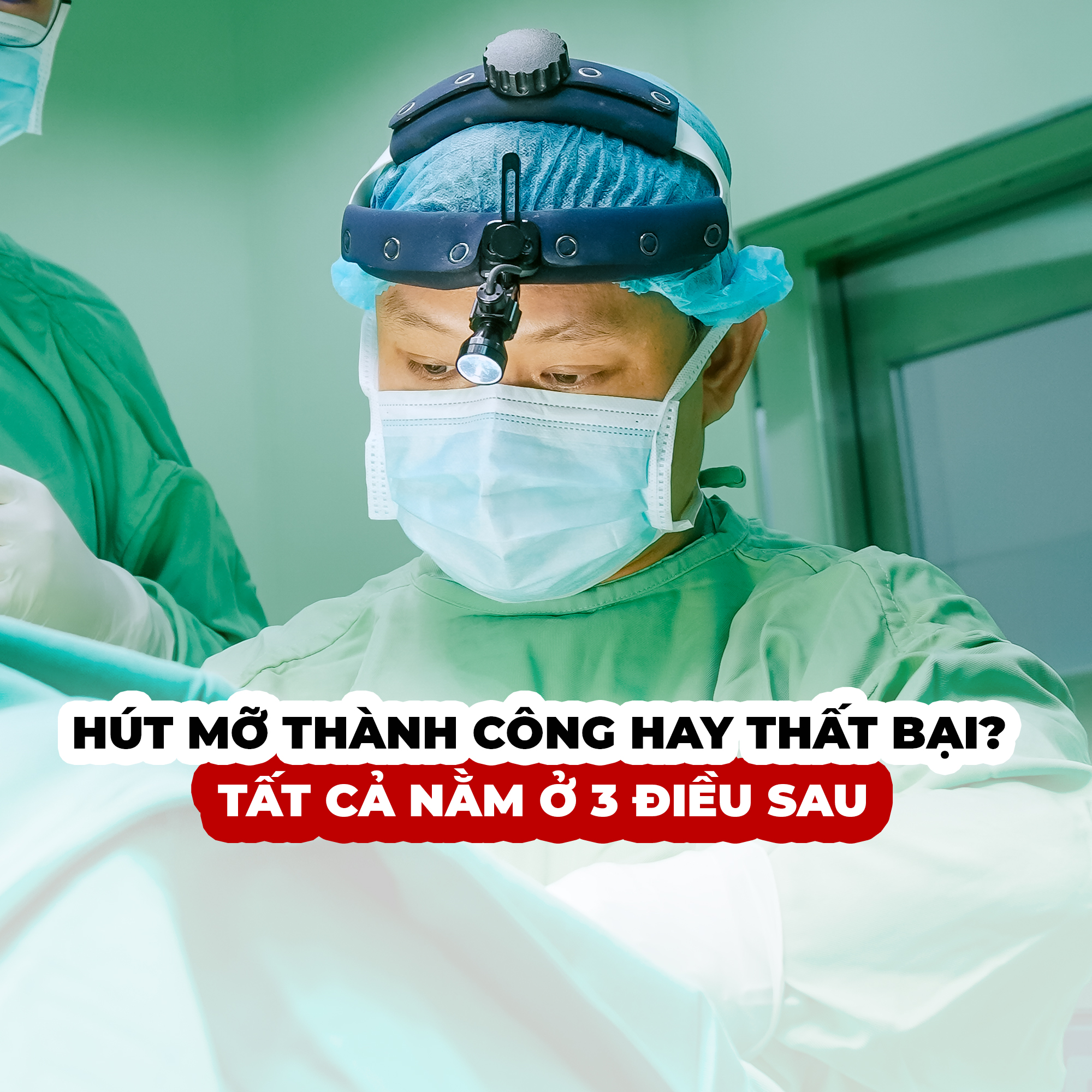 hút mỡ 1