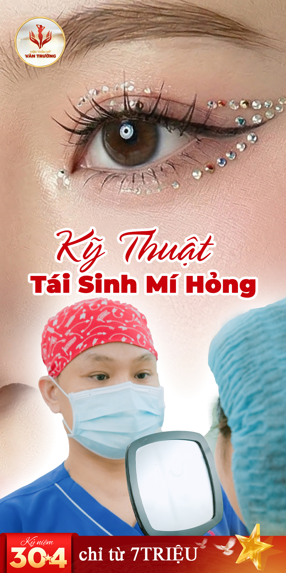 tái sinh mí hỏng 1