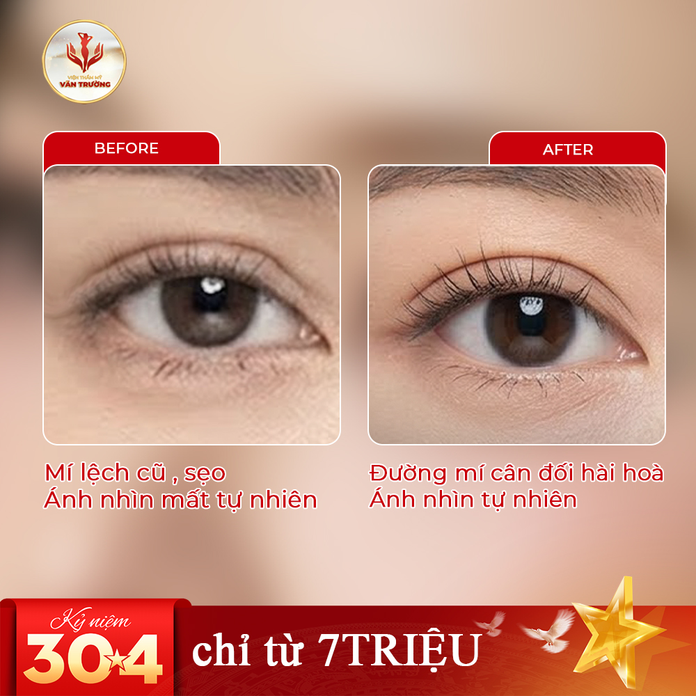 tái sinh mí hỏng 2