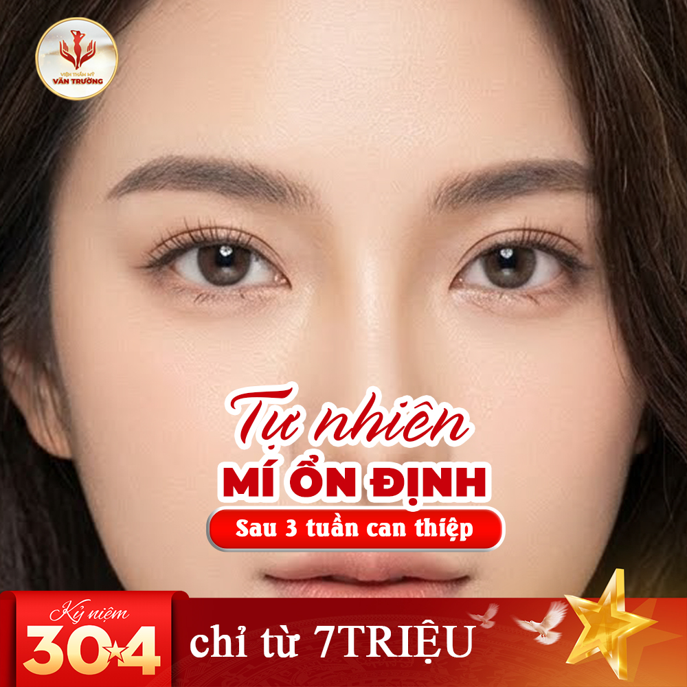 tái sinh mí hỏng 3