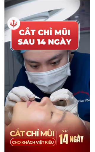 cắt chỉ mũi