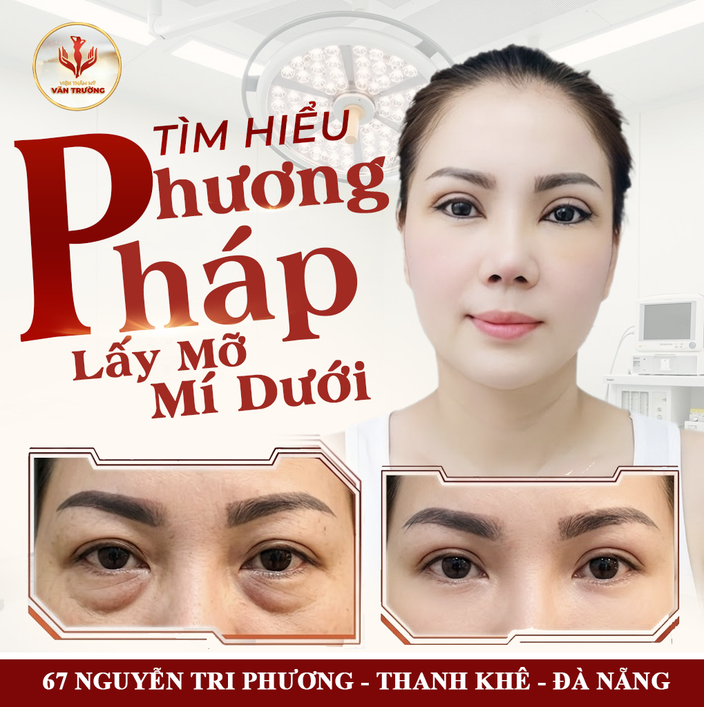 phuong phap lay mo mi duoi
