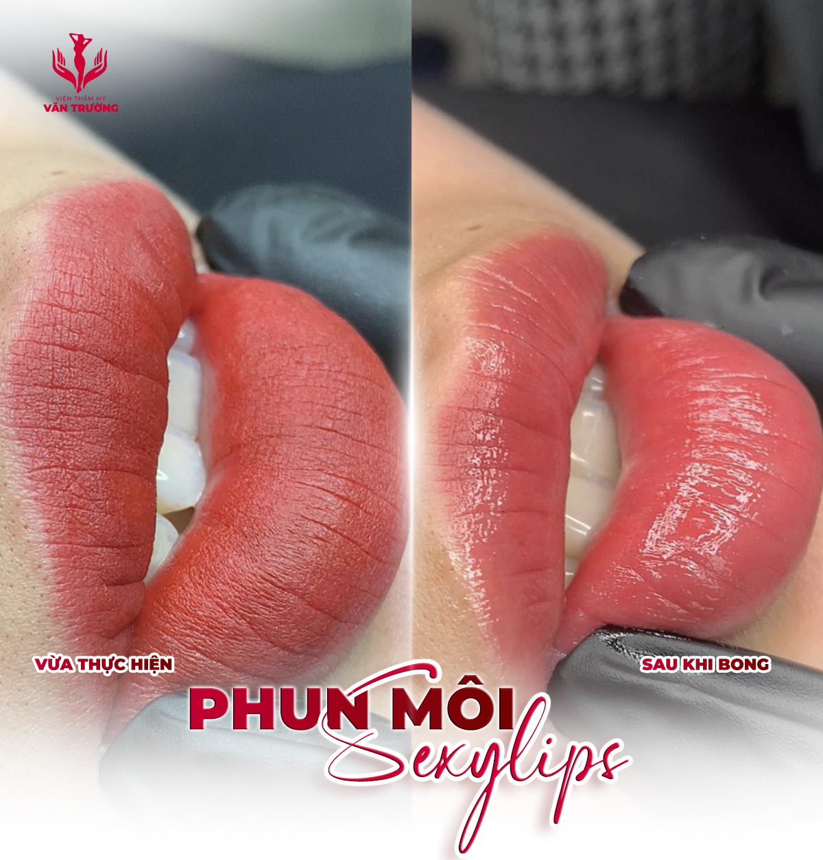 môi sexylips