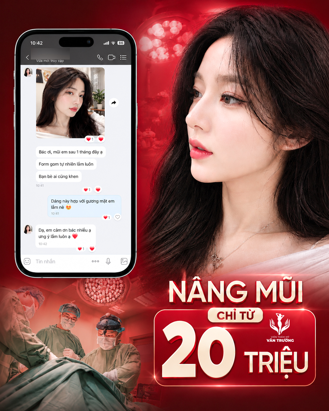 nâng mũi đẹp