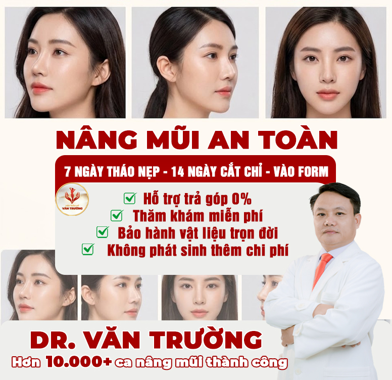 nâng mũi an toàn