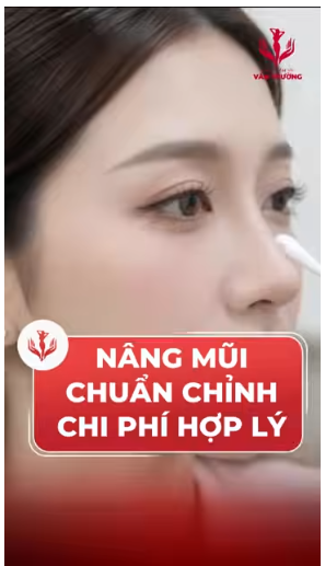 mũi đẹp