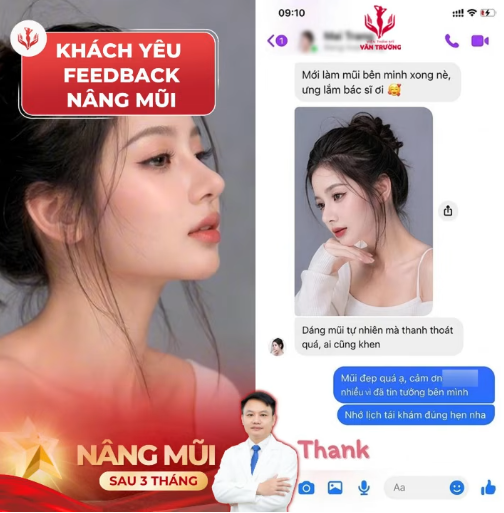 nâng mũi