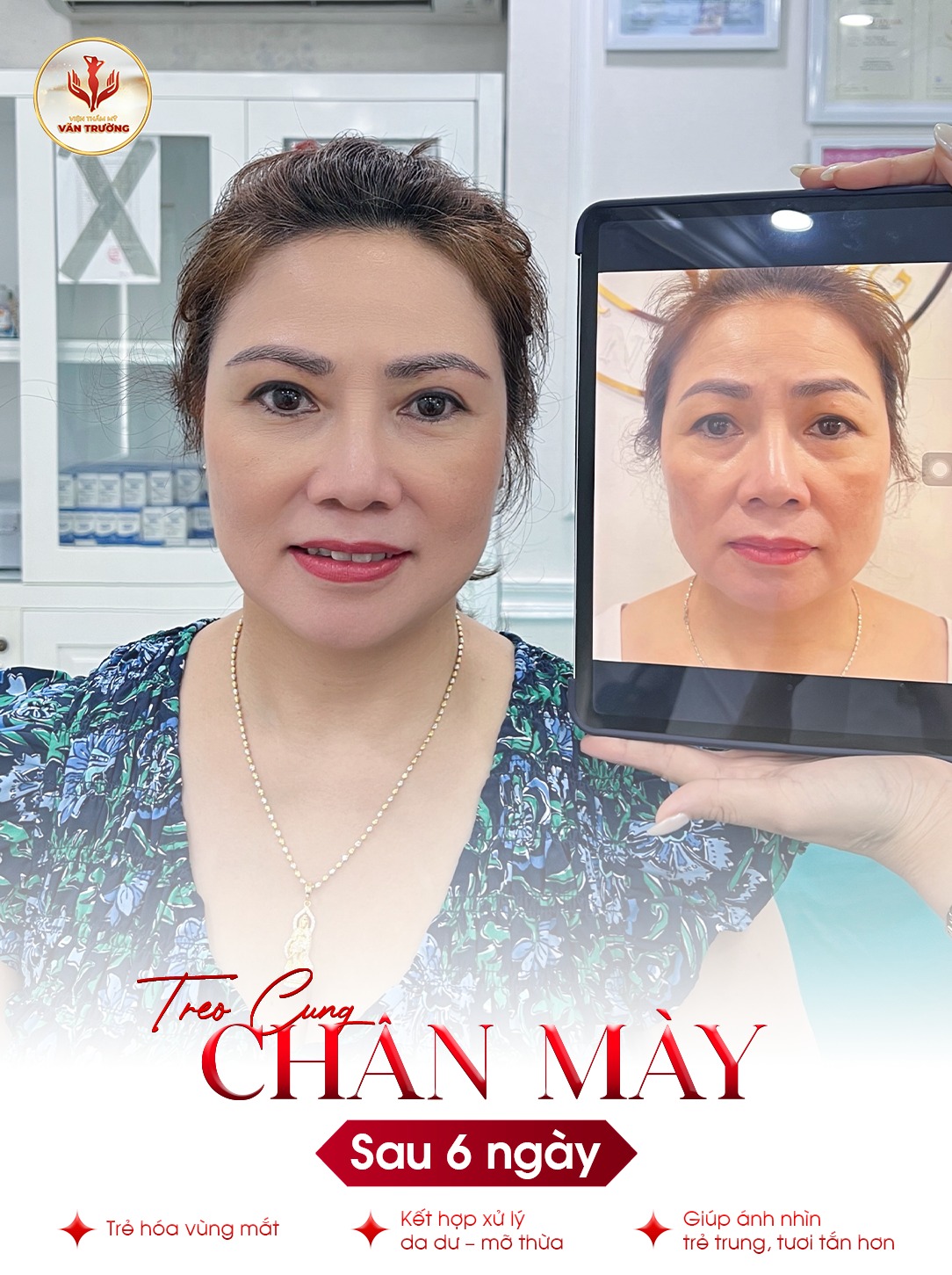 treo cung chân mày