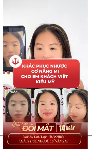 nhược cơ mi