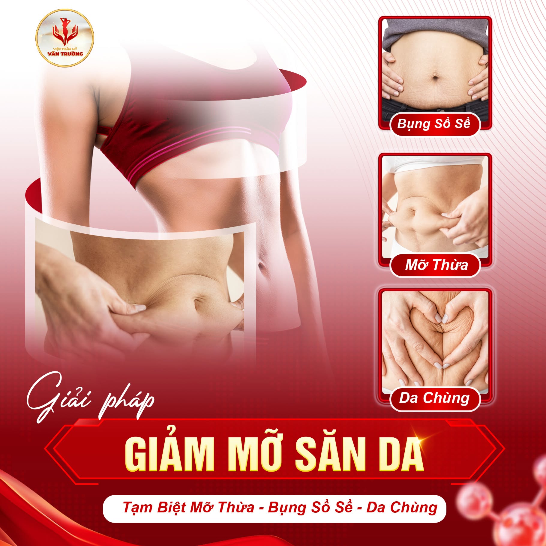 giảm mỡ