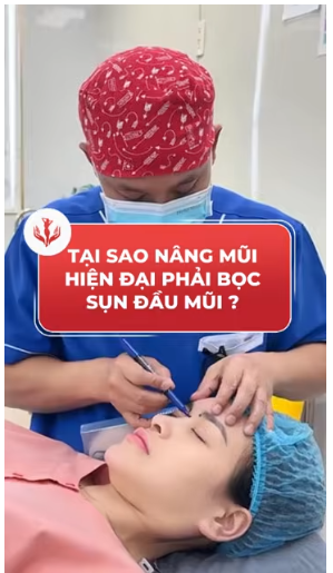 nâng mũi bọc sụn
