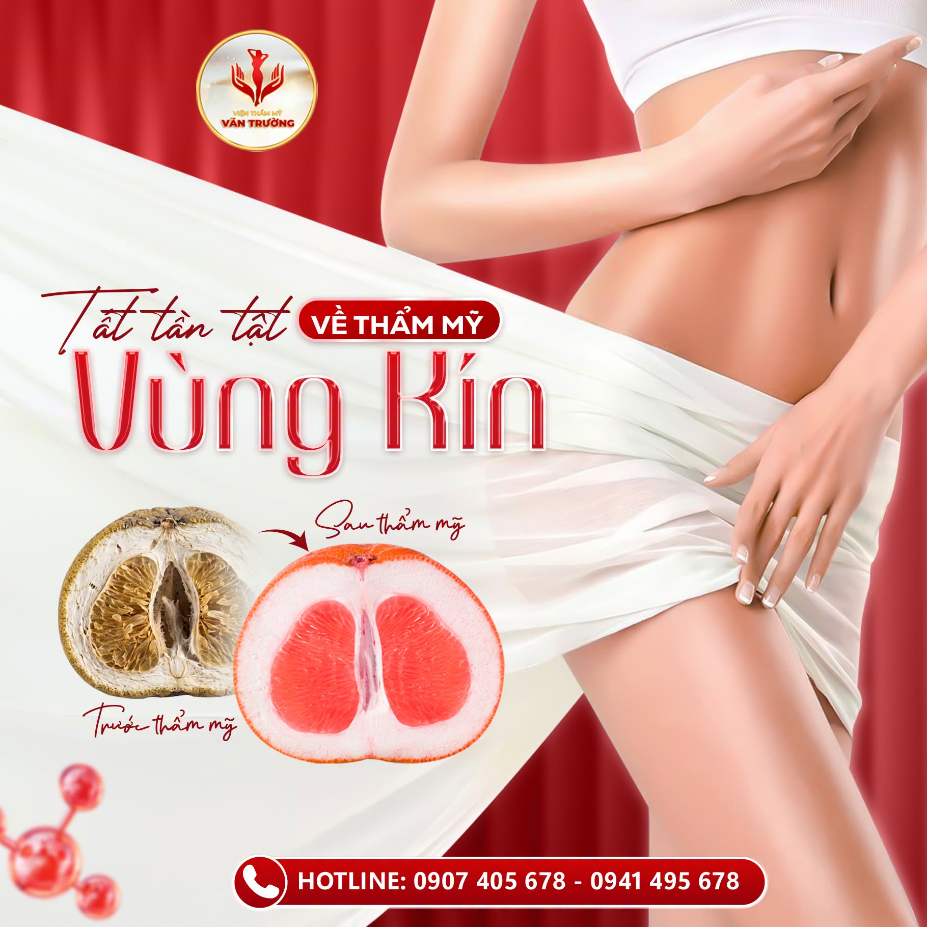 vùng kín