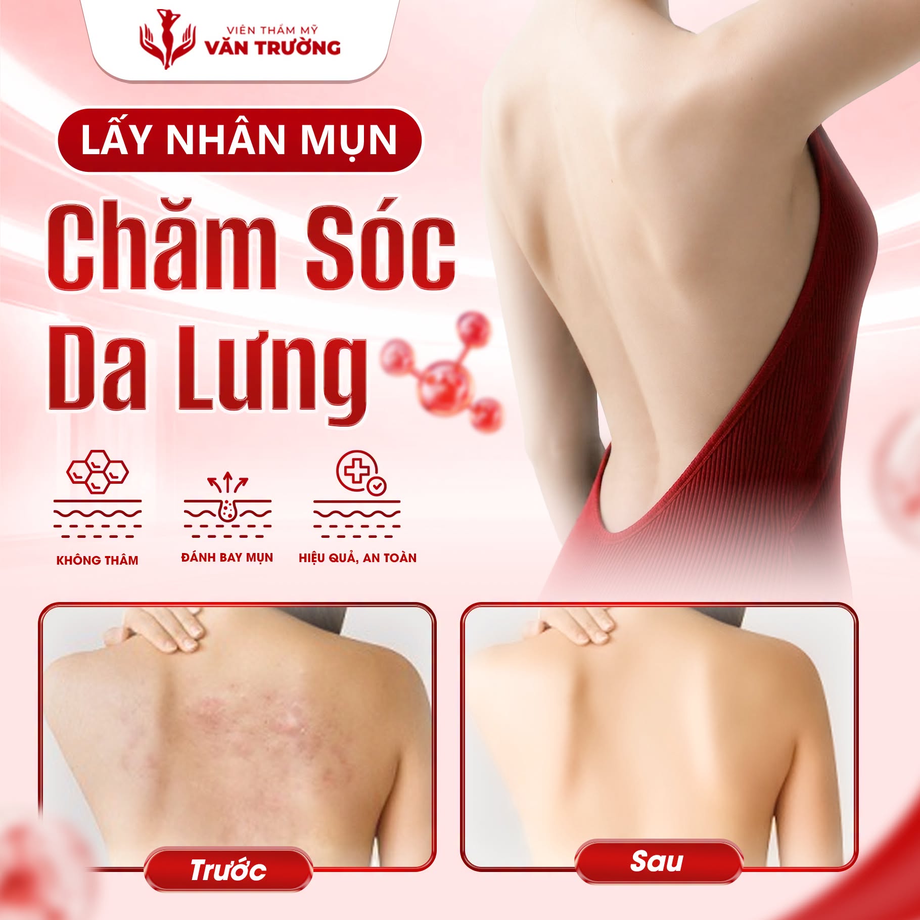 chăm sóc da lưng