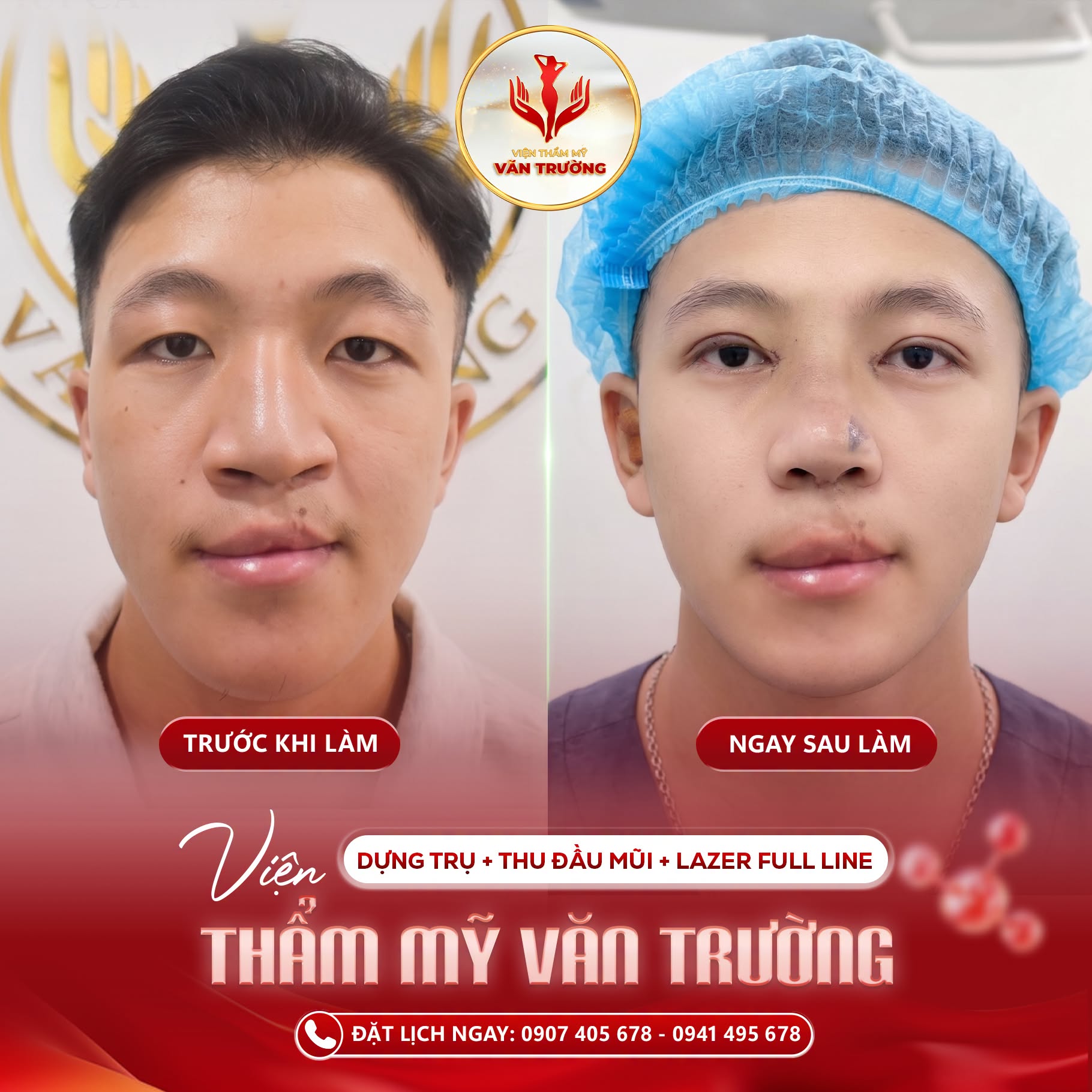 điêu khắc dáng mũi