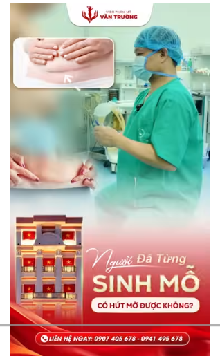 hút mỡ