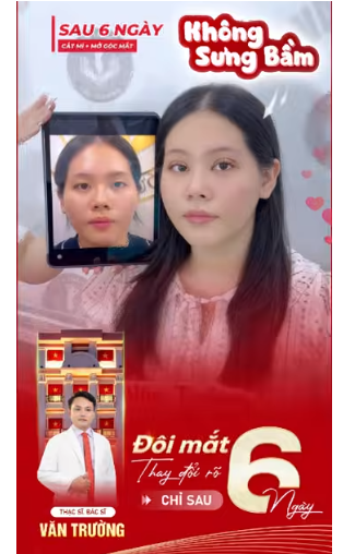 mắt to tròn