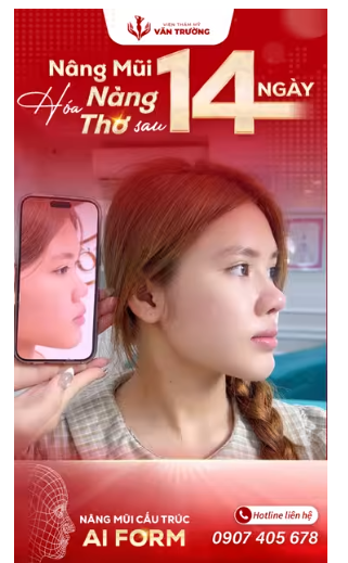 mũi ai form