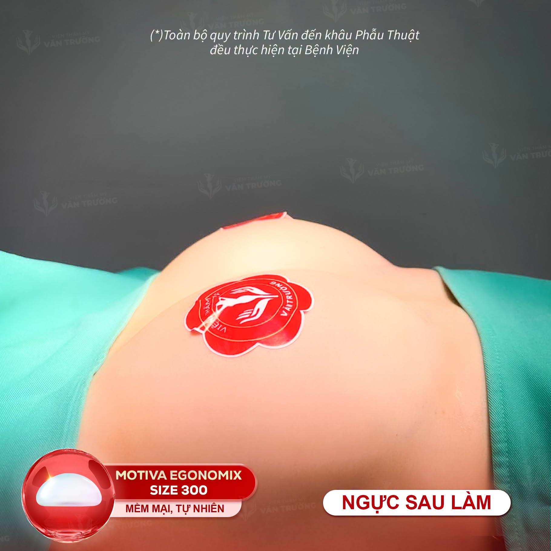 nâng ngực 2