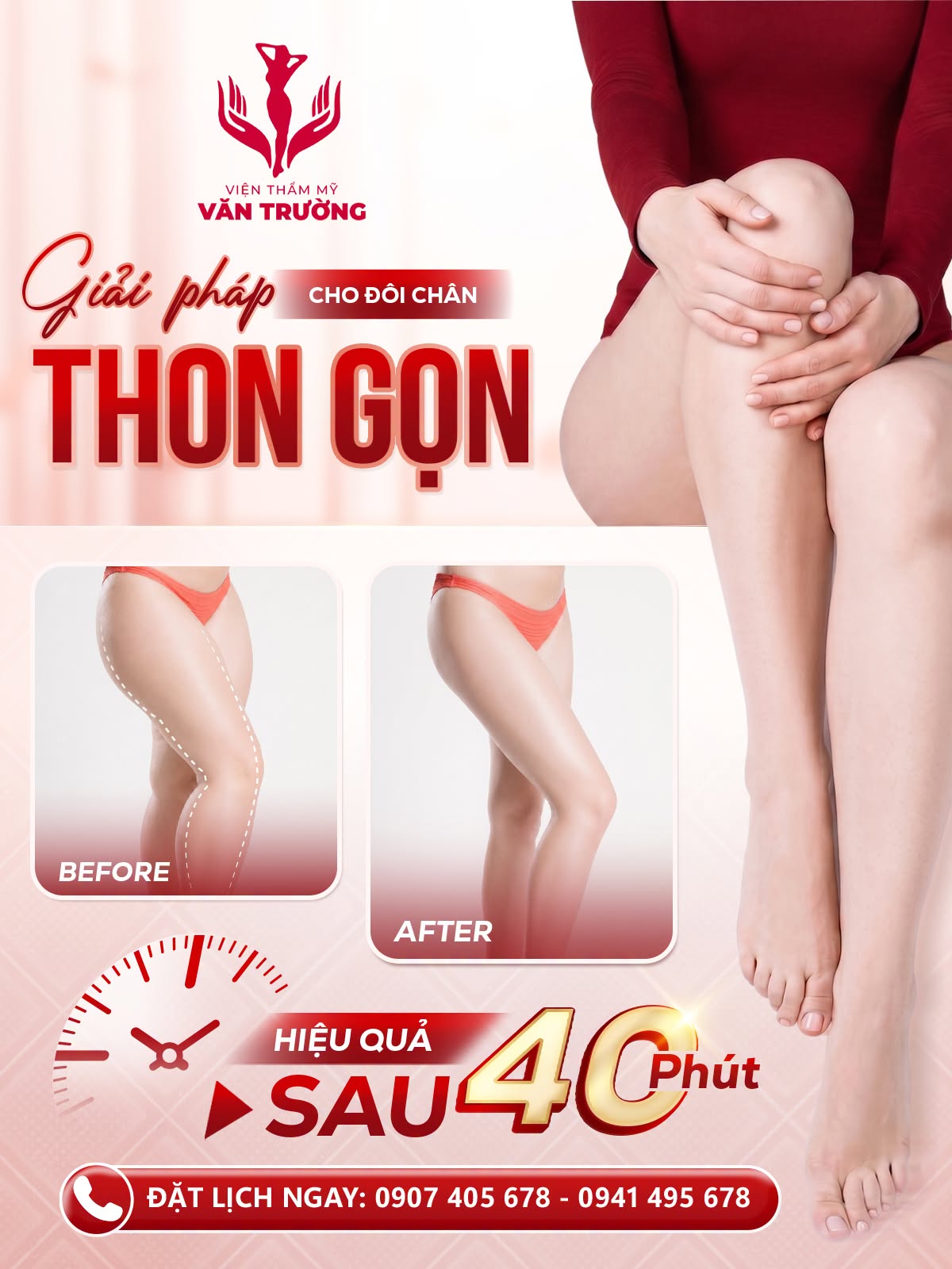 thon gọn
