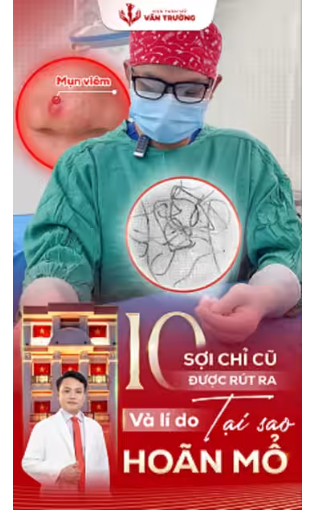 ca sửa mũi