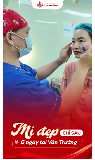 Cắt mí mắt