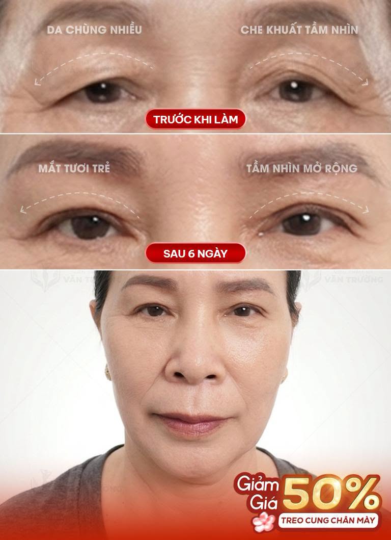 treo cung chân mày