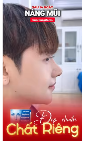 nâng mũi nam