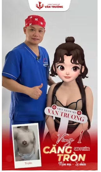 vòng 1 căng tròn