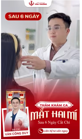 Cắt mí