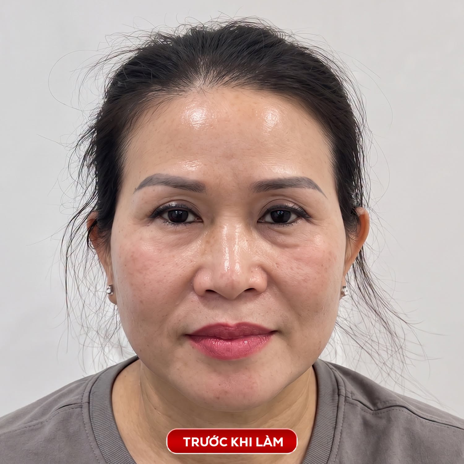 trước treo cung mày