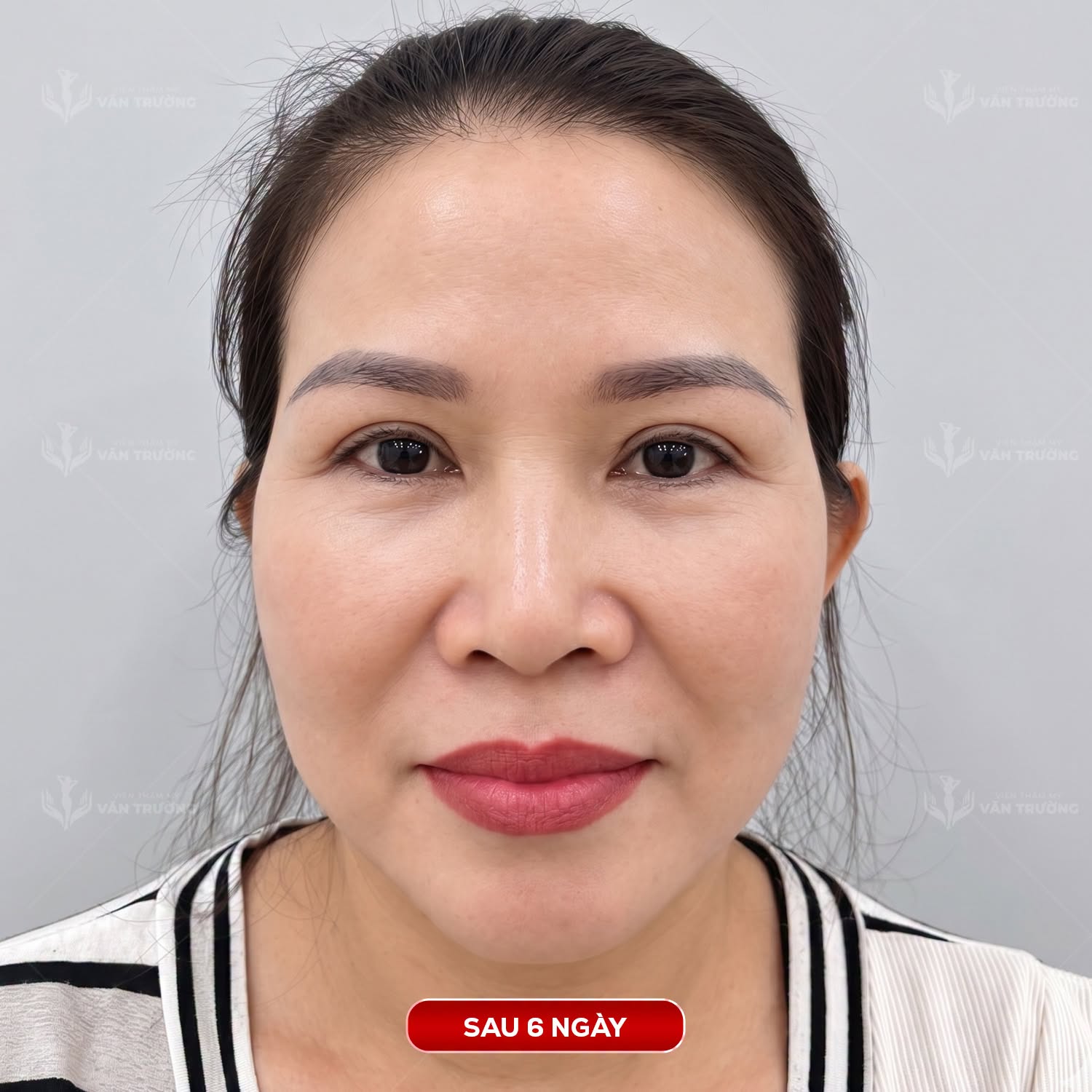 treo cung mày 2
